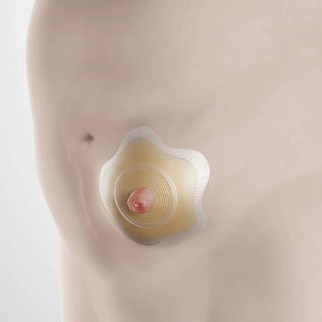 SenSura® Mio Click konkav Basisplatte mit Rastring